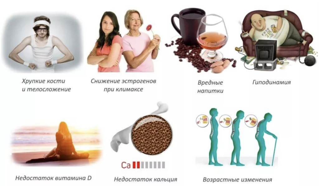Признаки остеопении.